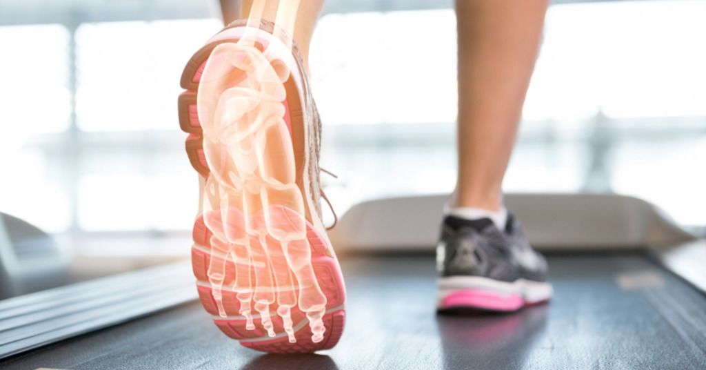 Das Foto zeigt einen Fuß im Laufschuh mit schematisch angedeuteten Knochen auf einem Laufband als Sinnbild für den Beitrag durch Nahrungsergänzungsmittel nach Knochenbruch